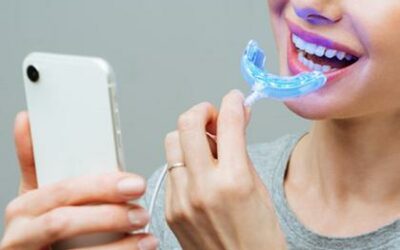 Riesgos de comprar blanqueamientos dentales en internet sin la supervisión de un dentista