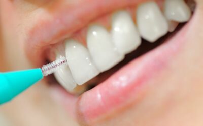 LA HIGIENE INTERDENTAL DIARIA, UNA ESTRATEGIA EFICAZ PARA REDUCIR EL SANGRADO GINGIVAL Y MEJORAR LA SALUD BUCAL
